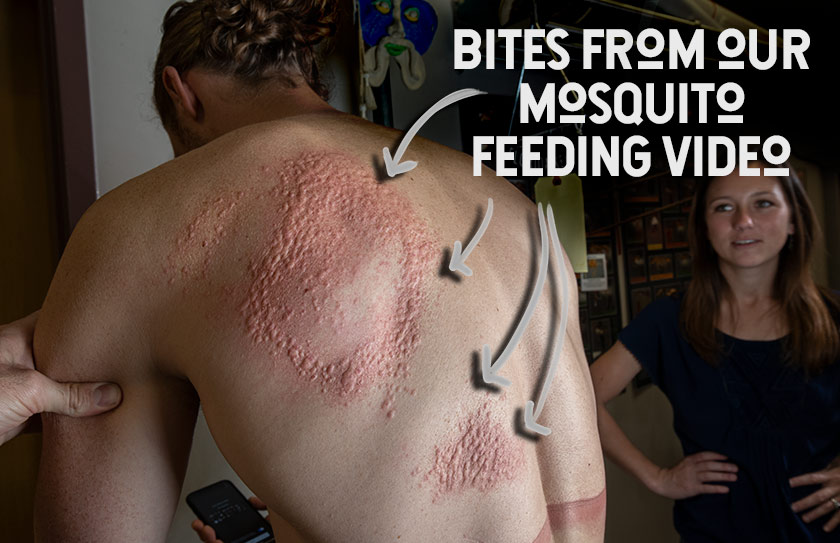 Surviving Mosquito "Attacks" and Bites MOSQUITO BASICS